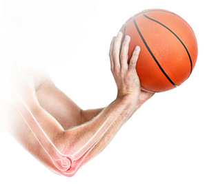 Thrower’s Elbow